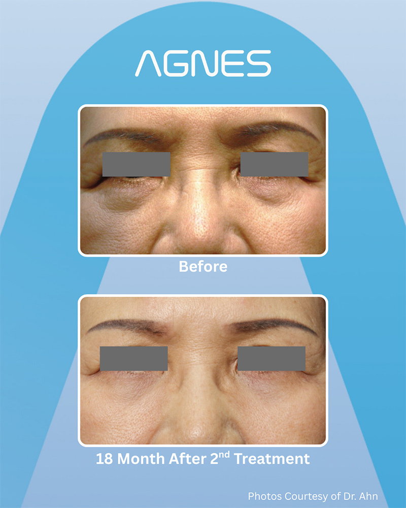 Picture of About Before Agnes3