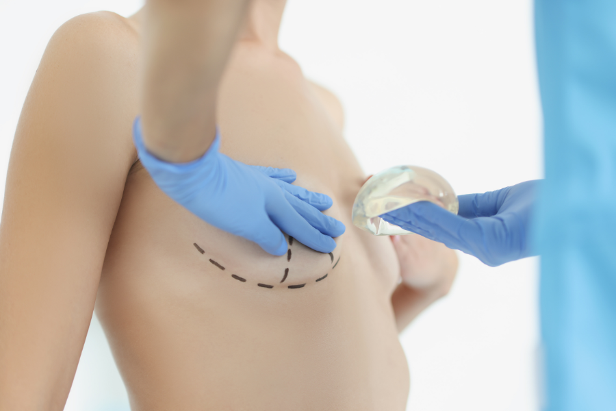 Picture of Asymmetric Breast Surgery