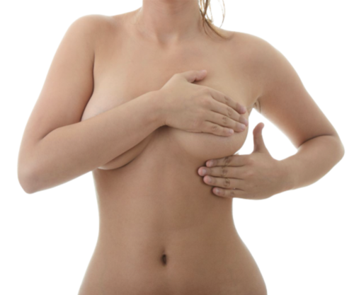 Breast Lift for an Asymmetric Breast Augmentation