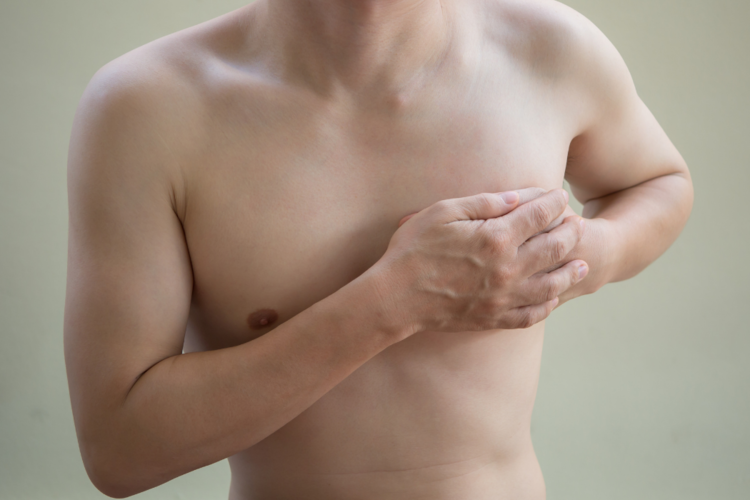 Picture of ArtfulSurgery Gynecomastia procedure process Lafayette California Bay area